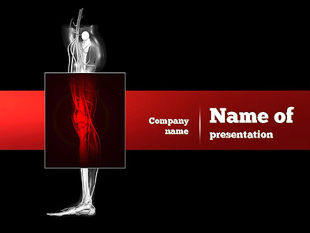Human Knee Presentation Template, Master Slide