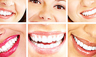 Dental Smile Presentation Template