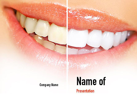 Teeth Whitening Presentation Template, Master Slide