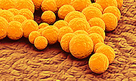 Staphylococcus Infection Presentation Template