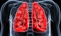 Respiratory Care Presentation Template
