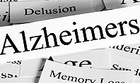 Alzheimer's Disease Presentation Template