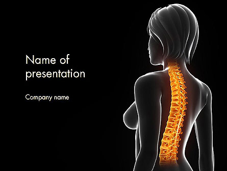 Female Spine Anatomy Presentation Template, Master Slide
