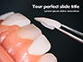 Dental Veneers Procedure Presentation slide 1