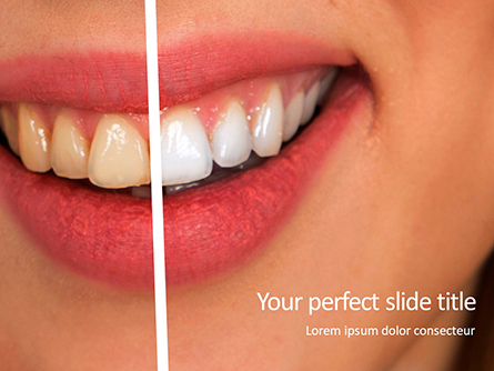 Woman Teeth Before and After Whitening Presentation Presentation Template, Master Slide
